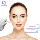 Anti Wrinkle 2ml Injectable Dermal Fillers Restore Youthful Skin For Lips